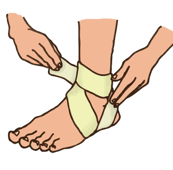 Kletterbeschwerden-umgeknöchelt